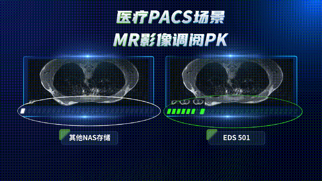上海市肺科医院的PACS影像阅片真实场景
